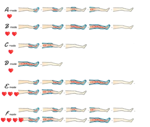 différents modes de compression